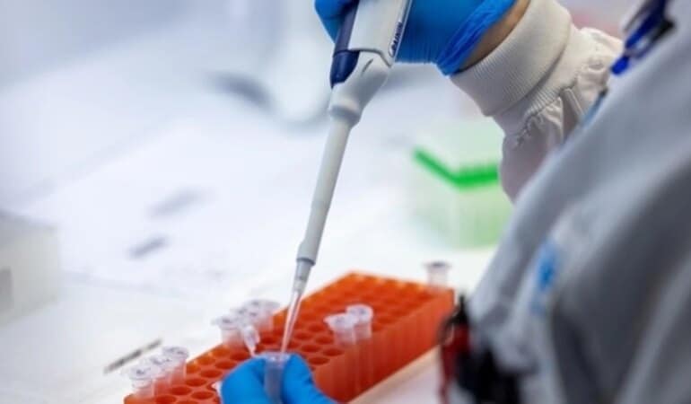 Maymun çiçeği bulaşma yolları nelerdir, nasıl bulaşır?