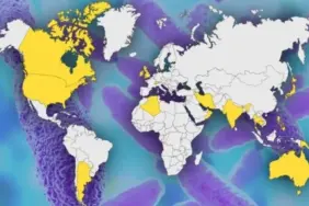 v2yeniproje-2024-08-06t124220947_1722937354