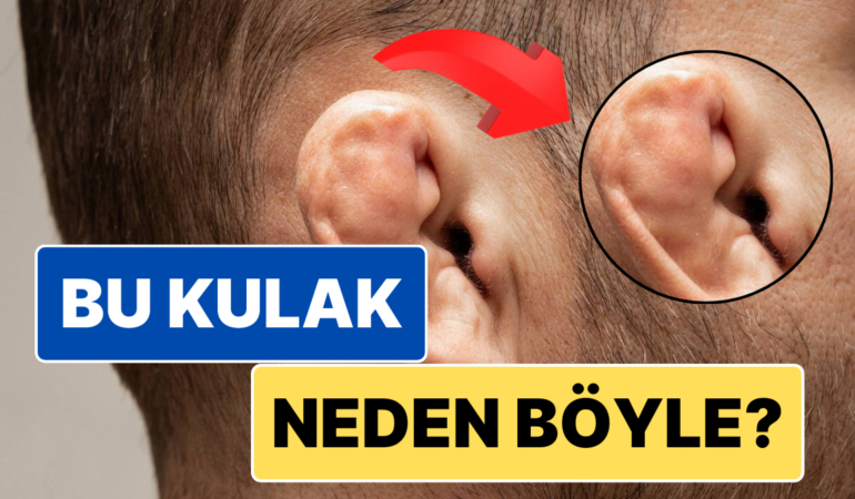 Güreş Kökenli Dövüşçülerin Kulaklarının Neden Karnabahara Benzediğini Biliyor muydunuz?