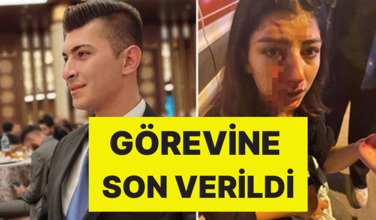 Konserde Genç Kadının Burnunu Kırdı: AK Parti Gençlik Kolları Başkanı Serbest Bırakıldı