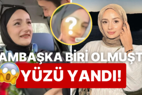 yuzu-yandi-tum-turkiyeye-amin-dedirten-tiktok-fenomeni-gizem-yildiz-estetik-kurbani-oldu-Xmngyaw8.jpg