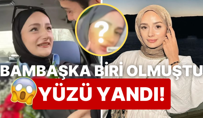 Yüzü Yandı: Tüm Türkiye’ye “Amin” Dedirten TikTok Fenomeni Gizem Yıldız, Estetik Kurbanı Oldu!