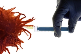 kanser-asisi-kanser-hucresi-getty-1677544-1024x576