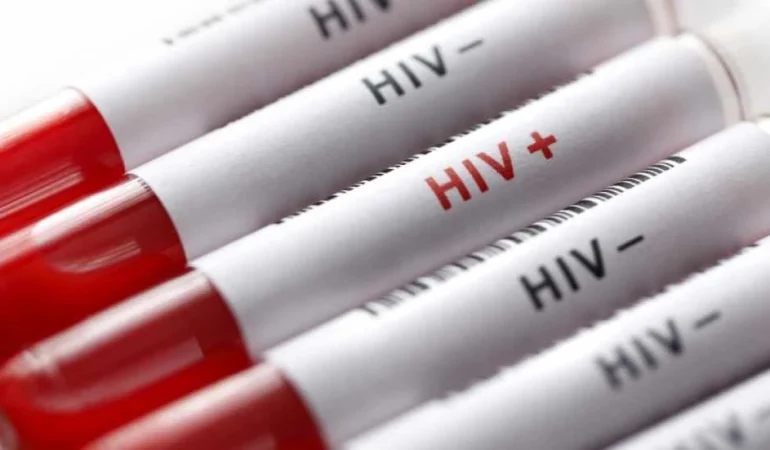 BİYOLOGLAR DERNEĞİ AIDS GÜNÜ DOLAYISIYLA AÇIKLAMA YAPTI: SÜRDÜRÜLEBİLİR BİR HIV POLİTİKASI OLUŞTURULMASI GEREKİYOR