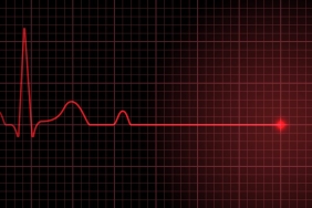 21 yaşındaki Buse Kara’nın ölüm sebebi “akciğer enfeksiyonu ve pulmoner emboli”