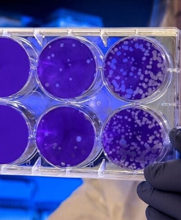 abc-abd-hantavirus-vakalarini-3-seviye-acil-durum-koduyla-takibe-aldi.jpeg