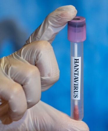 dso-hantavirus-enfekte-kisi-icin-tehlikeli-ancak-genel-nufus-icin-dusuk-riskli.jpeg