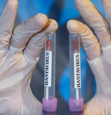 hantavirus-1-3d8f70.webp.webp