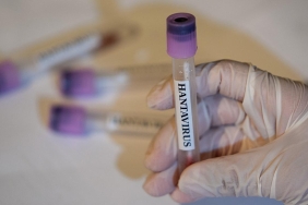 hantavirus-2459284.jpg