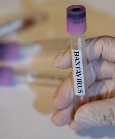 hantavirus-enfeksiyonu-erken-donemde-grip-ile-karistirilabiliyor.jpeg