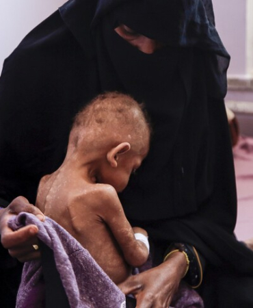 1781626187759yemen.jpg