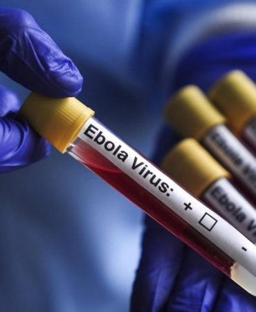 1782471477183ebola-vir-s.jpg