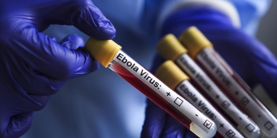 Kongo Demokratik Cumhuriyeti’ndeki Ebola Salgınında Bilanço AğırlaşıyorVaka Sayısı 1155’e Ulaştı